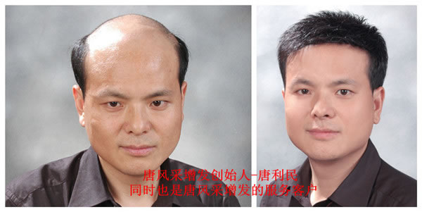 ����Ó�l(f��)��ԭ����