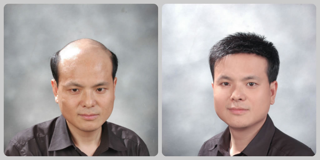 �d플�(du��)��