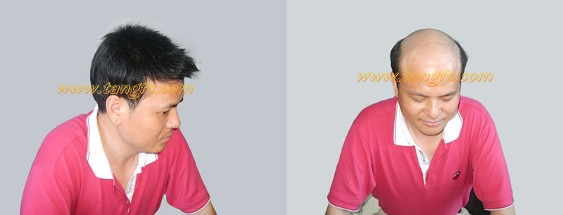 ��ʲô׌�װl(f��)׃��