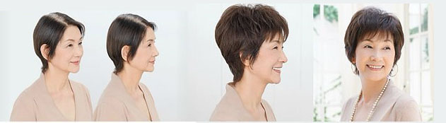 少年白發(fā)會遺傳嗎？