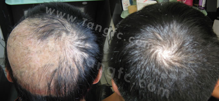 太原織發(fā)補發(fā)哪家做的專業(yè)？