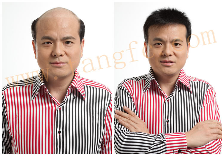 用什么洗頭可以生發(fā)？