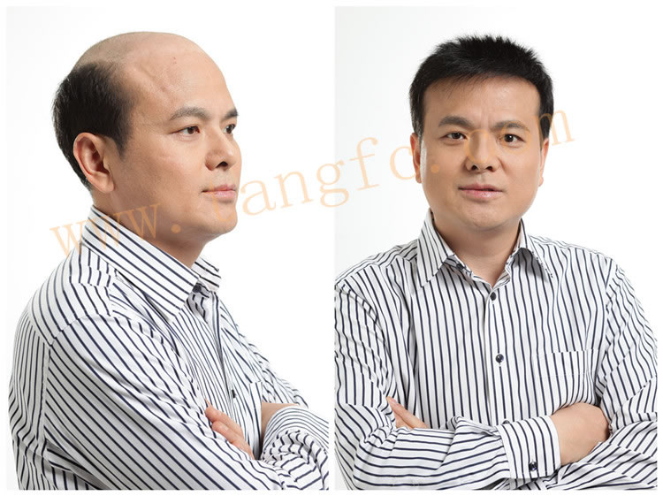 了解假發(fā)價(jià)格。高檔假發(fā)價(jià)格多少？