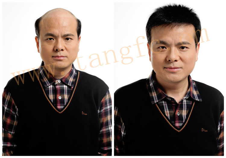 選擇男士假發(fā)需要注意什么？