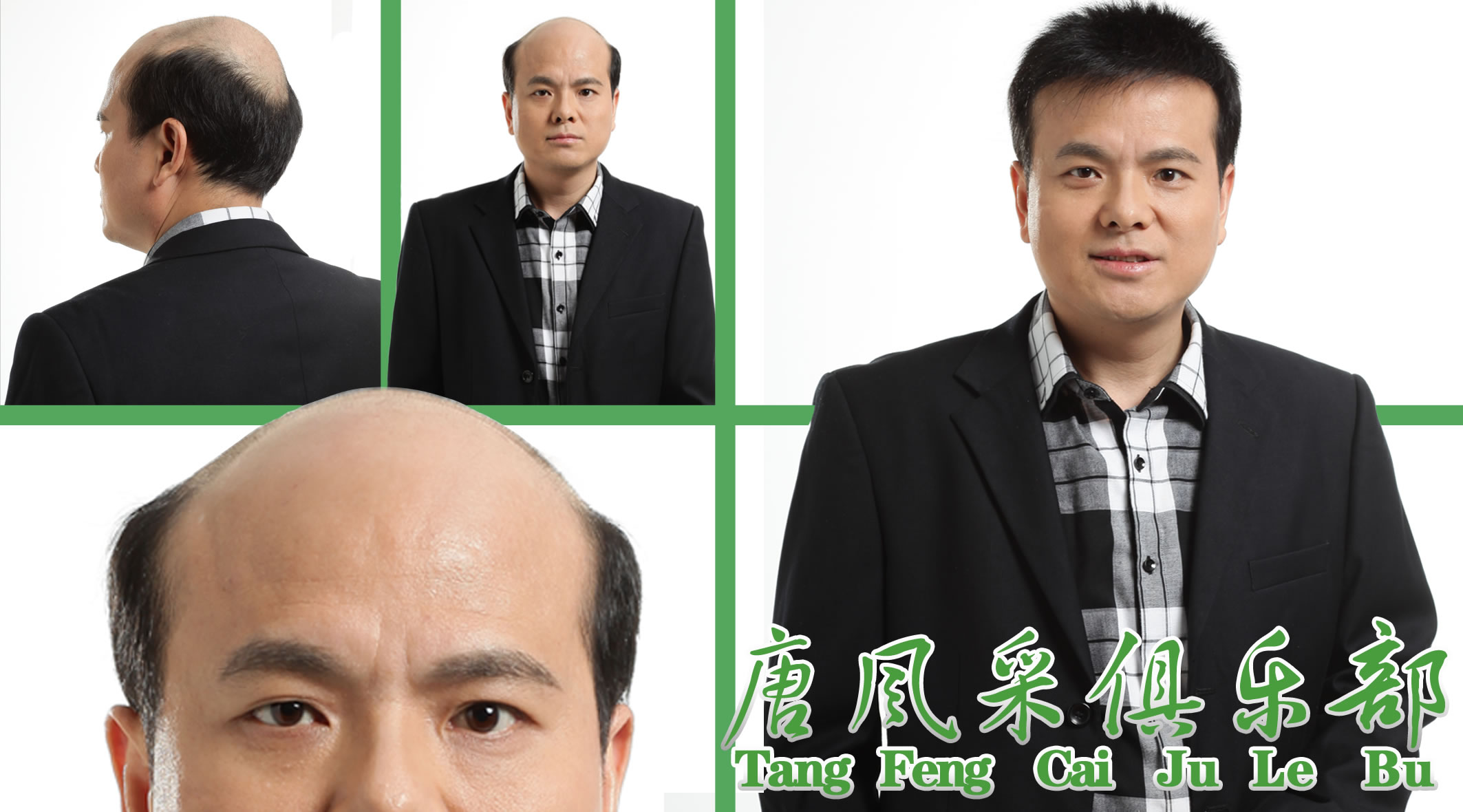 假發(fā)、跟織發(fā)有什么區(qū)別