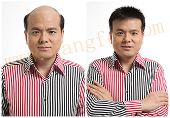 織發(fā)都有哪些優(yōu)勢(shì) 表現(xiàn)在哪些方面？