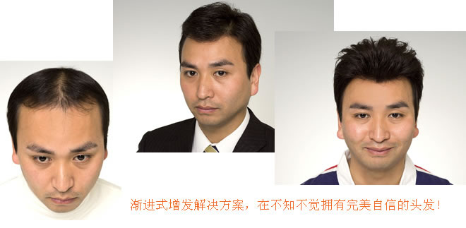 怎么洗頭才不容易脫發(fā)？