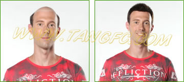 請問織發(fā)跟假發(fā)有什么區(qū)別么？