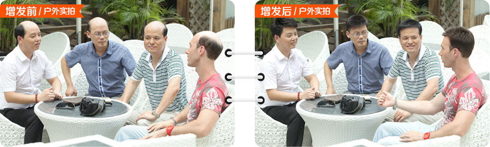 黑發(fā)變白怎么辦？