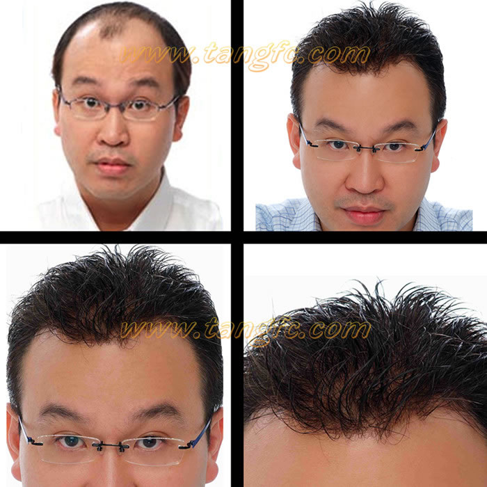 唐風采織發(fā)補發(fā)