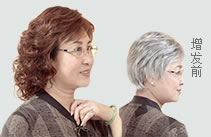 女士織發(fā)補發(fā)案例