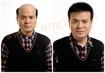 廣州哪里有唐風(fēng)采假發(fā)？