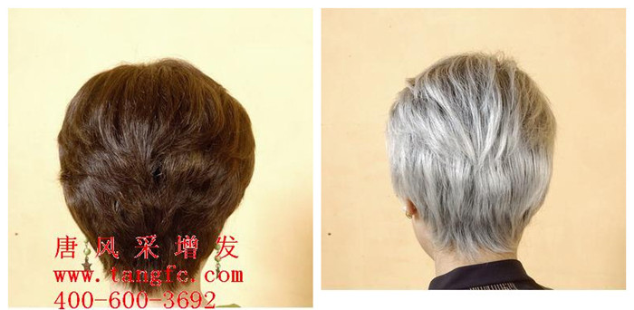 怎樣才能讓白發(fā)變黑？分享白發(fā)變黑方案！