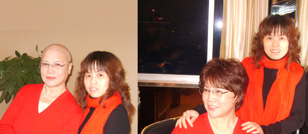 女性頭發(fā)稀疏謝頂怎么辦？如果發(fā)體稀疏就要避免這些！