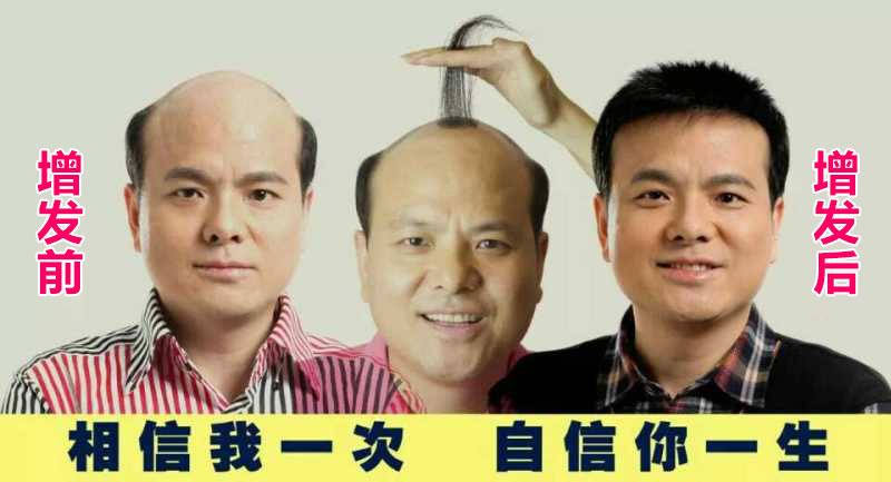 哪家自然織發(fā)效果好？