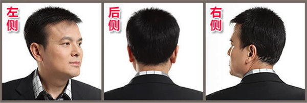 頭發(fā)再生技術(shù)怎么樣 再生發(fā)體是怎么操作的