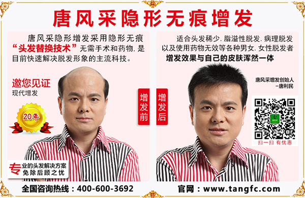 禿頂植發(fā)要多少錢？脫發(fā)禿頂又與頭皮屑有什么關(guān)聯(lián)？