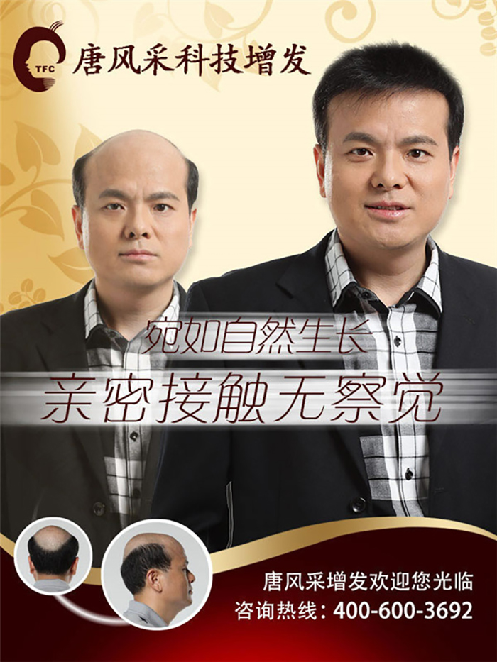 真頭發(fā)假發(fā)為什么這么受歡迎？