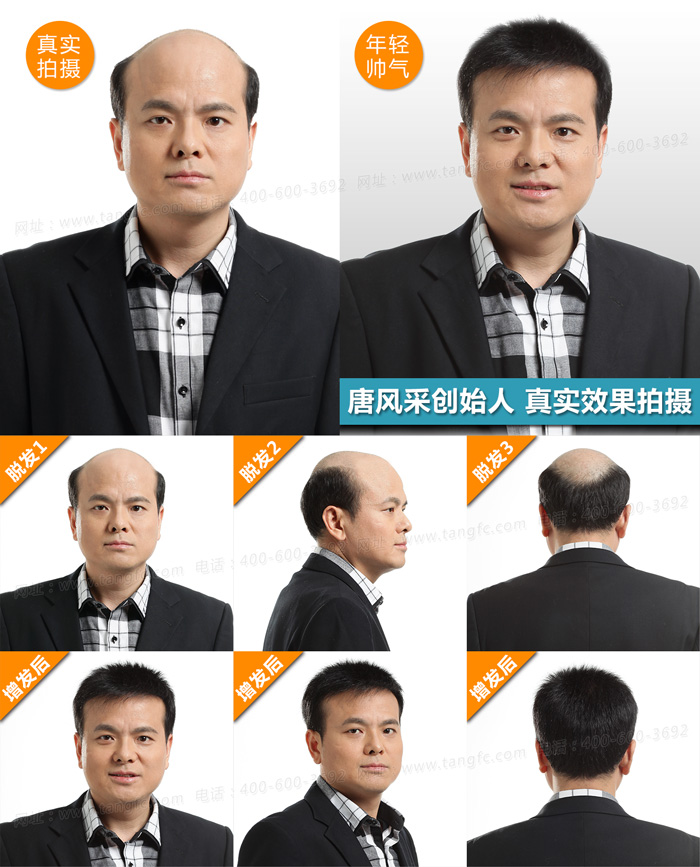 禿頂了，品牌假發(fā)定做為你保駕護航