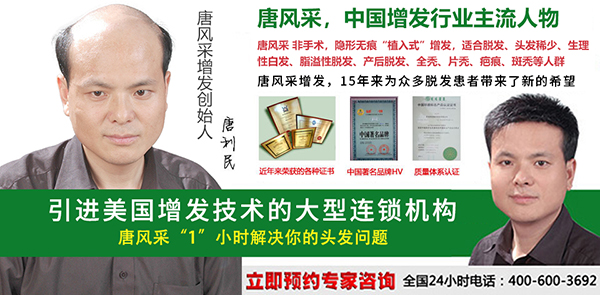 早禿怎么辦？哪里能進(jìn)行男士頭發(fā)加密？