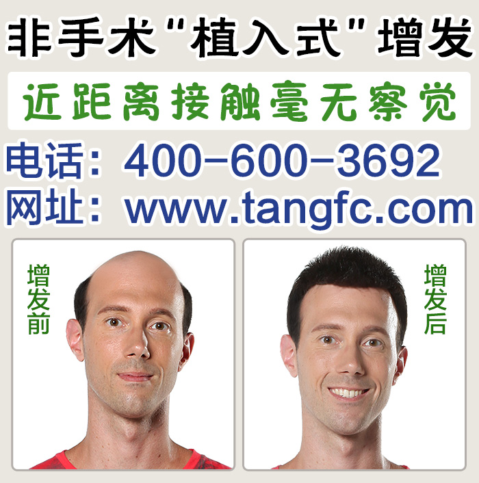 脫發(fā)怎么辦？品牌假發(fā)定做技術成熟嗎？