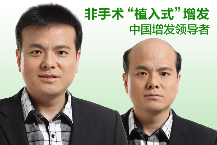 頭發(fā)稀少用什么？預(yù)防與解決需要懂這些