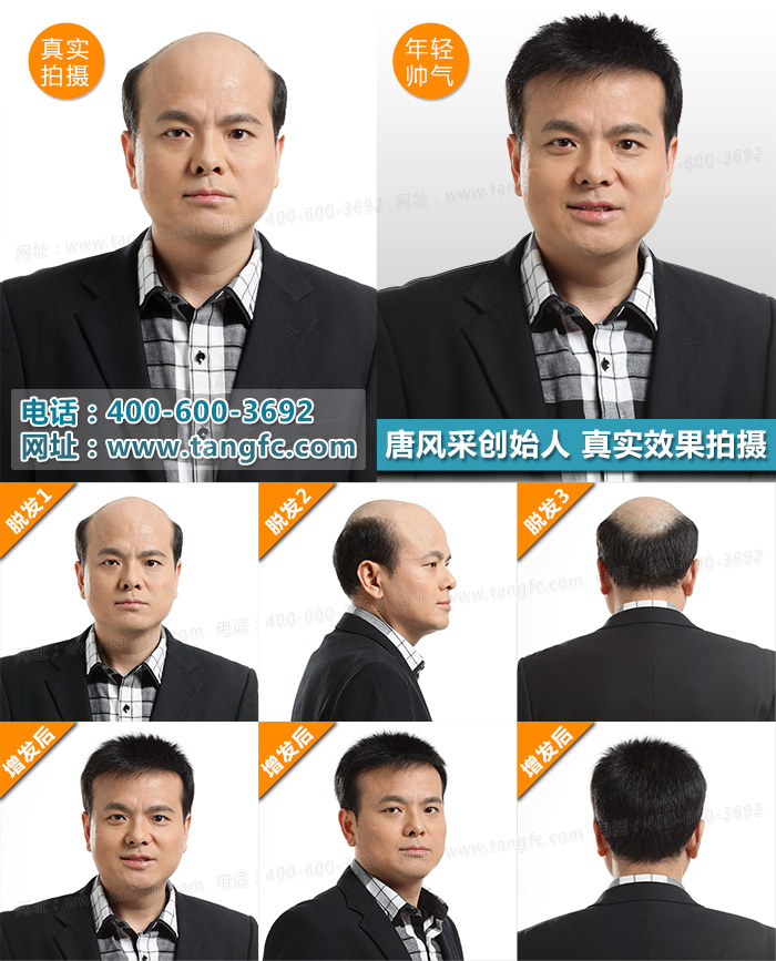 呼和浩特哪里有織發(fā)？織發(fā)后如何護(hù)理？