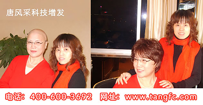 女士假發(fā)什么牌子好？高端假發(fā)領(lǐng)導(dǎo)者就是這個(gè)牌子！