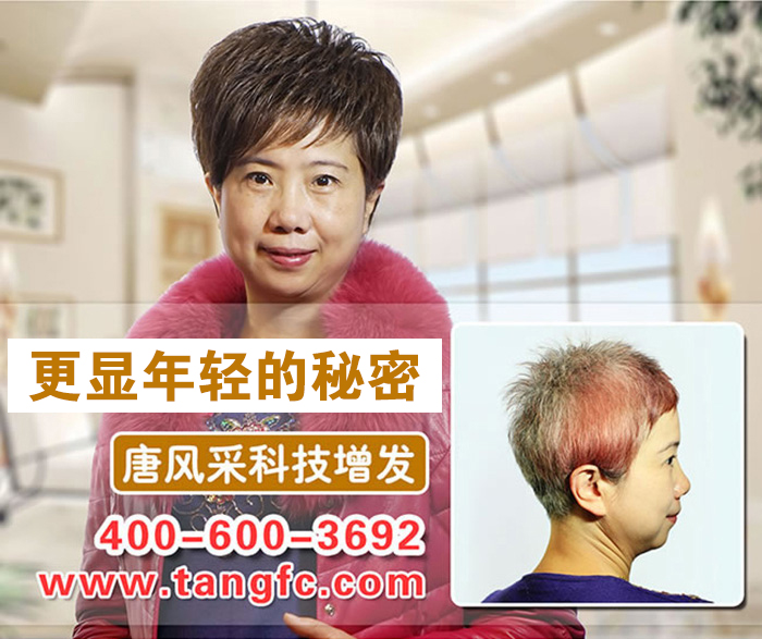 南寧最好的織發(fā)店在哪？脫發(fā)用織發(fā)可以救嗎？