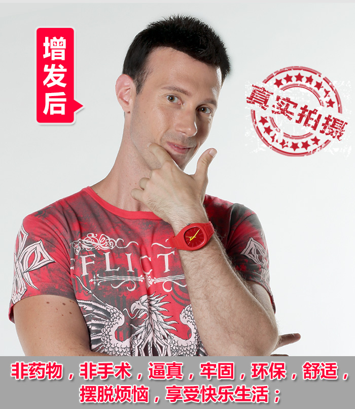 補發(fā)多久拿掉？這家補發(fā)技術(shù)最好