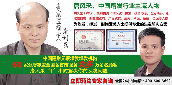 年輕人禿頂怎么辦？唐風(fēng)采效果告訴你答案！