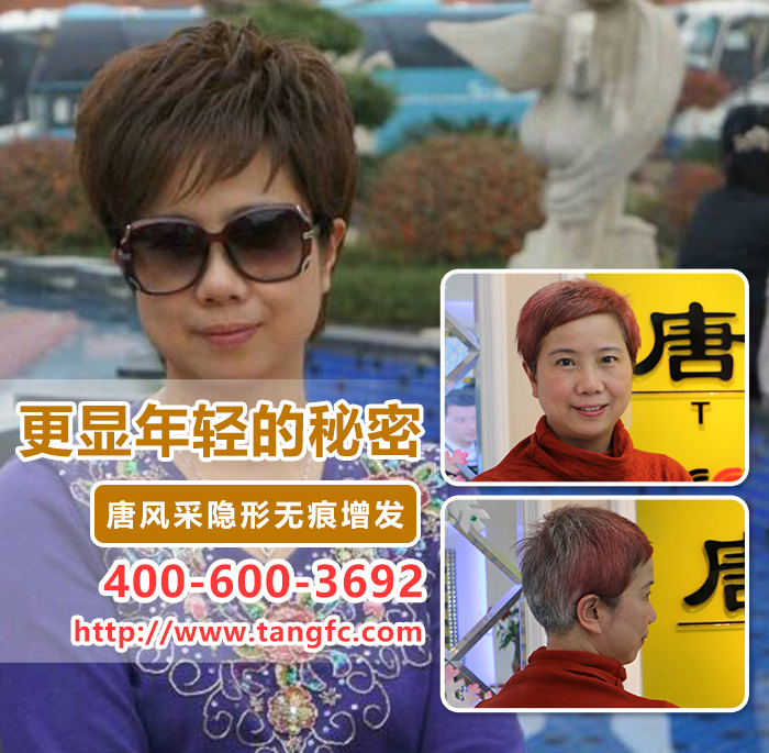 頭發(fā)稀少怎么補發(fā)？2016補發(fā)新型技術！