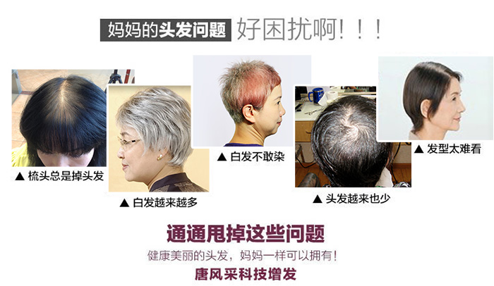 男子發(fā)帖抱怨過早白發(fā)，偶得白發(fā)變黑技術(shù)