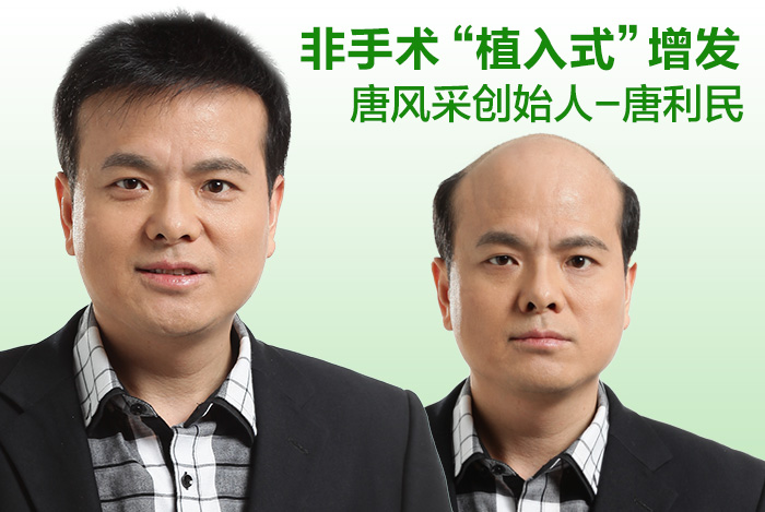 紹興假發(fā)專賣店，假發(fā)誰需要？