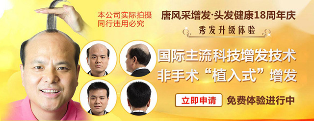 臨沂買假頭發(fā)去哪家？好秀發(fā)如何養(yǎng)成