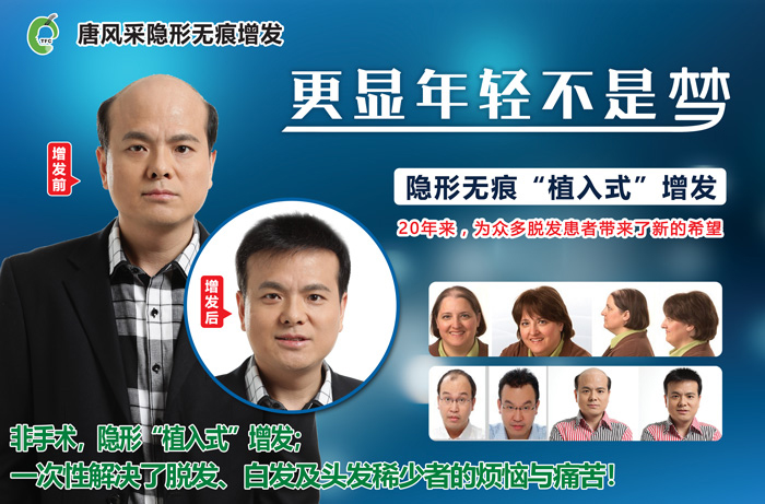 溫州男士假發(fā)專業(yè)定制，假發(fā)應(yīng)該怎么護(hù)理