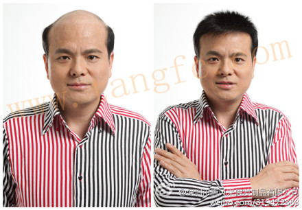 如何選擇男士假發(fā)專賣店？這類人易得雄脫