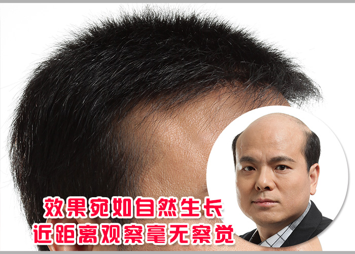 蘭州假發(fā)片定制哪家好？頭發(fā)在這都能得到完美解決