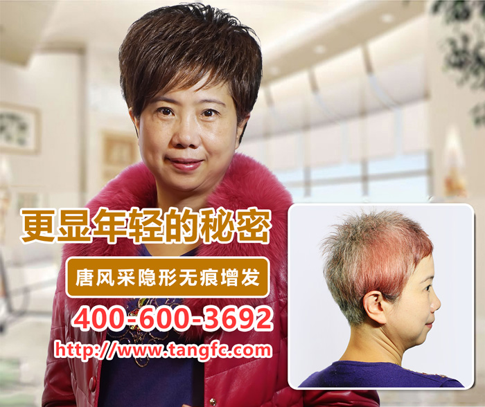 大同白發(fā)人看過來，白發(fā)多愛脫發(fā)1小時就搞定了