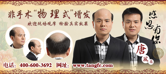 漳州好的假發(fā)去哪買？這些脫發(fā)的原因你知道嗎？