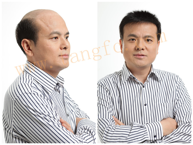 沈陽哪里做真人假發(fā)的？教你如何選好假發(fā)