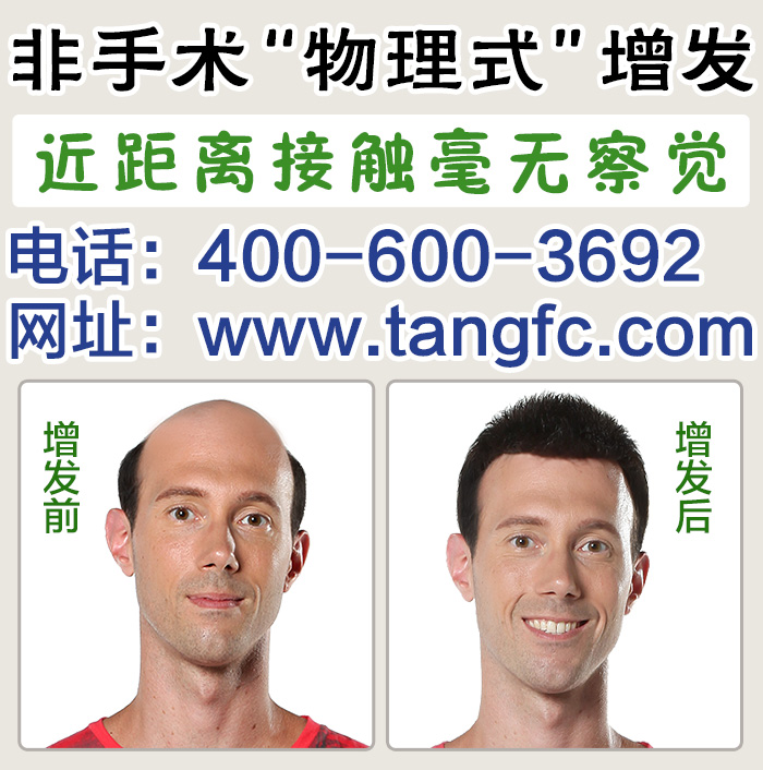 游戲男別為頭發(fā)困擾，唐風采上海補發(fā)機構(gòu)為您解決問題！