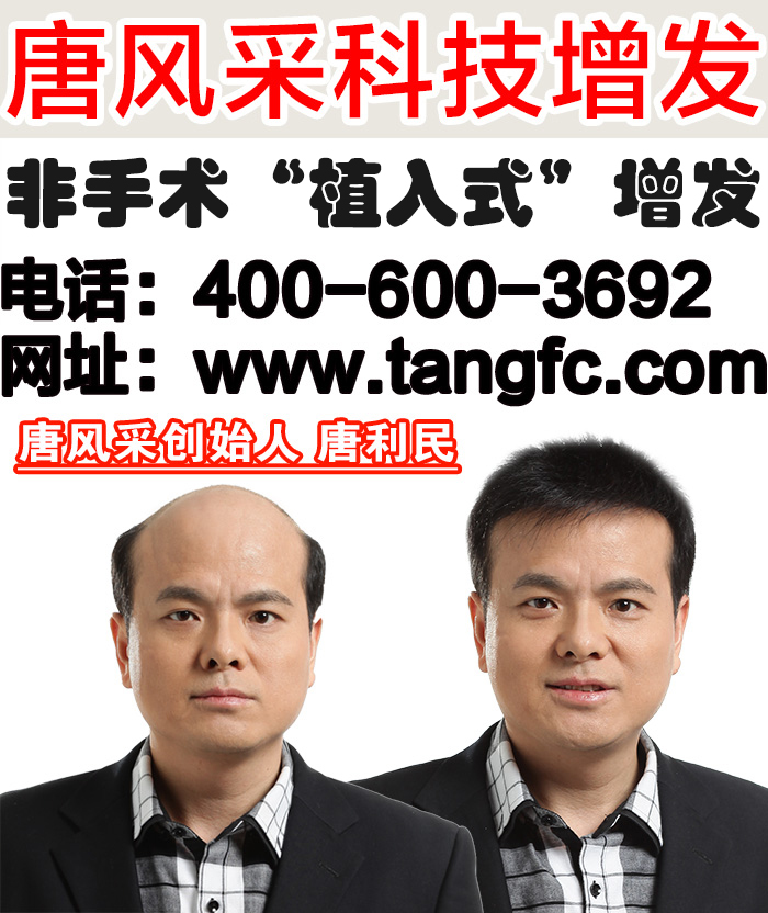 真人發(fā)中年男士假發(fā)多少錢？中年人為何易禿