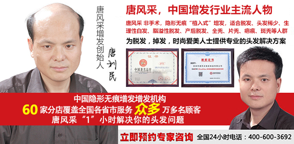 傳統(tǒng)男士假發(fā)套和補發(fā)的區(qū)別，長期戴哪種更好？