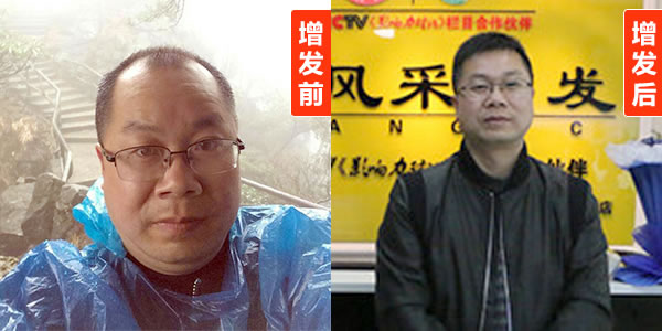 常德織發(fā)哪里好？細(xì)節(jié)決定成敗!