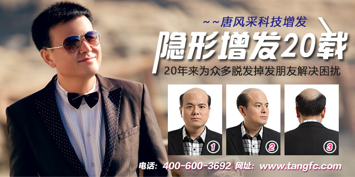 哈爾濱織發(fā)定制去哪能做？是真人發(fā)的嗎