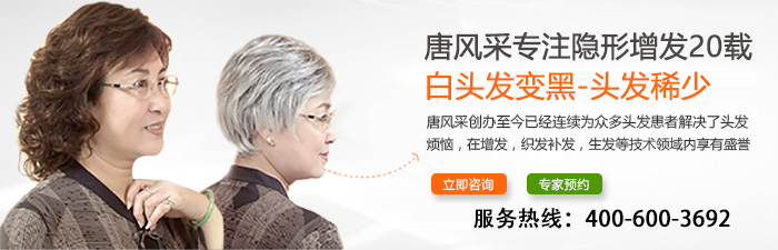 長沙假發(fā)什么牌子好？千萬別貪小便宜吃了大虧