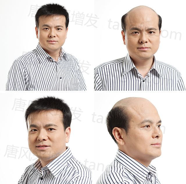 蘭州假發(fā)片定制哪家好？頭發(fā)在這都能得到完美解決