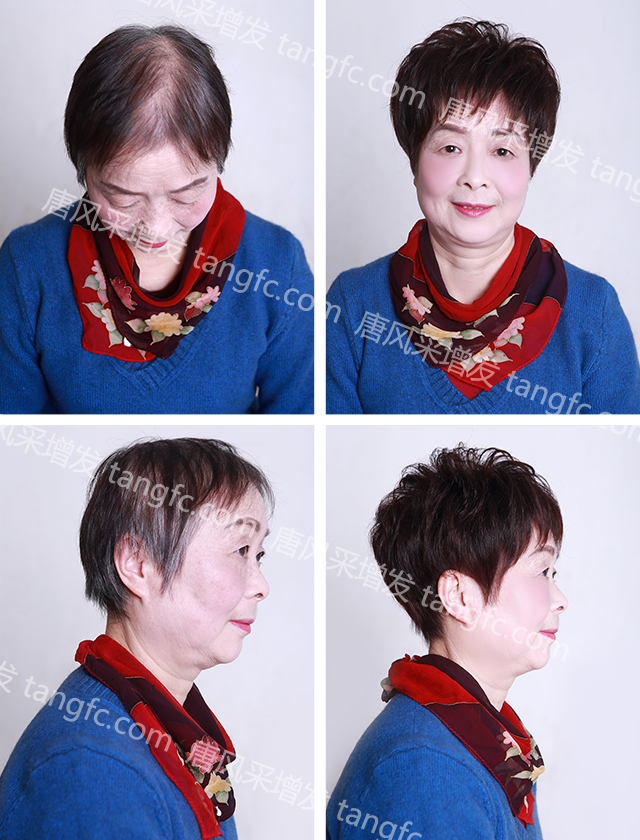 呼和浩特哪里賣女士假發(fā)？發(fā)量少買什么假發(fā)？