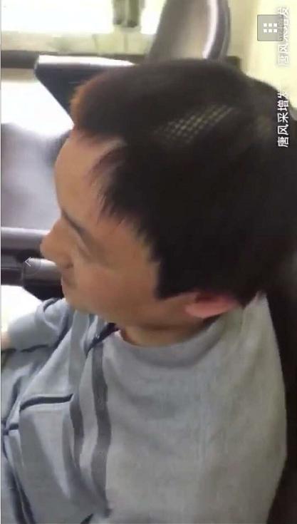 沒有對比就沒有傷害—市場假發(fā)與唐風(fēng)采真人假發(fā)差距實錄